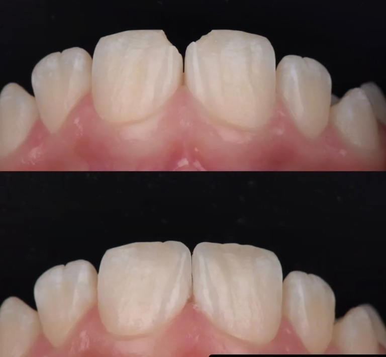 Biomimetic dentistry in Madurai