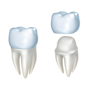 Zirconia Crown