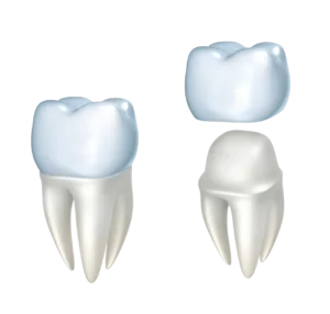 Zirconia Crown