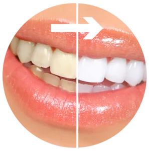 Cosmetic dentistry
