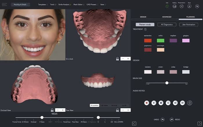 digital smile design/gem dentistry